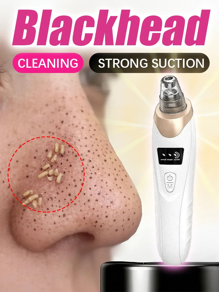 Blackhead Remover pimples and blackheads vacuum pores removal facial skin cleansing device For Deep cleaning home
