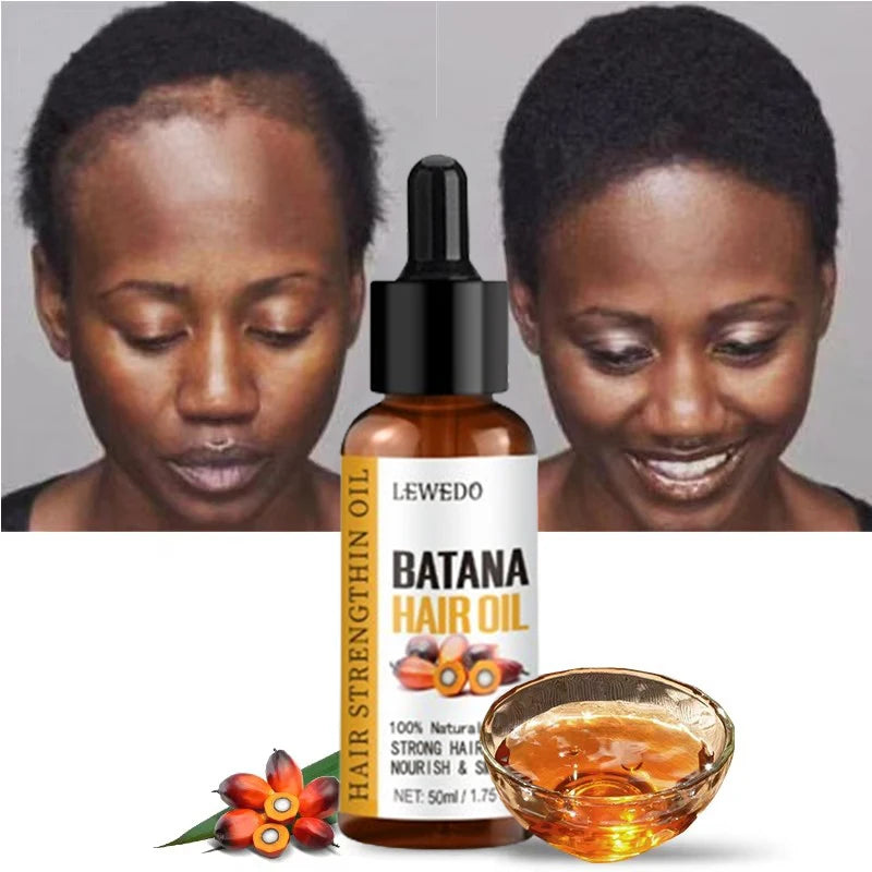 Lewedo Naturals Batana Oil Fast Hair Growth for Men Women Pure Batana Oil Nourish Shiny Hair Healthy Hair Care Anti Hair