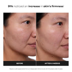Paula's Choice CLINICAL 1% Retinol Face Treatment with Peptides, Vitamin C & Licorice Extract, Anti-Aging Skin Care Serum, Fine Lines & Wrinkles, Fragrance Free