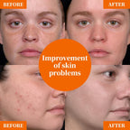 Vitamin C Serum 20% for Face, Anti-Aging & Hydrating Serum with Hyaluronic Acid & Niacinamide, Helps Reduce Wrinkles, Plump Skin, Even Tone, for All Skin Types, 1 Fl Oz