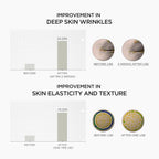 SKIN1004 Retinol 0.2% Boosting Shot Ampoule, Face Serum for Skin Elasticity, Facial Spicule Serum with Retinol & Retinal, Centella Ampoule for Fine Lines & Firmness, Korean Skin Care, 1.01fl.oz / 30ml