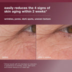 Dermalogica Dynamic Skin Retinol Facial Serum with Multi-Retinoid Complex, Skin Retexturizing and Improving Skin Health